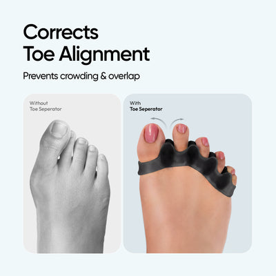 Frido Orthotics Toe Separator